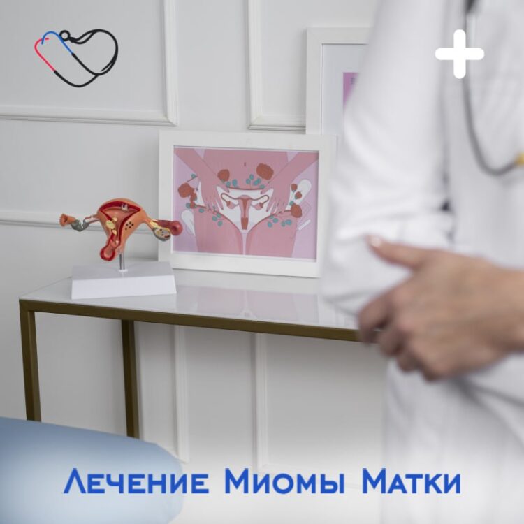 🌸 Лечение миомы матки