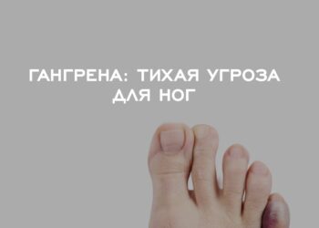 Гангрена. Тихая угроза для ног
